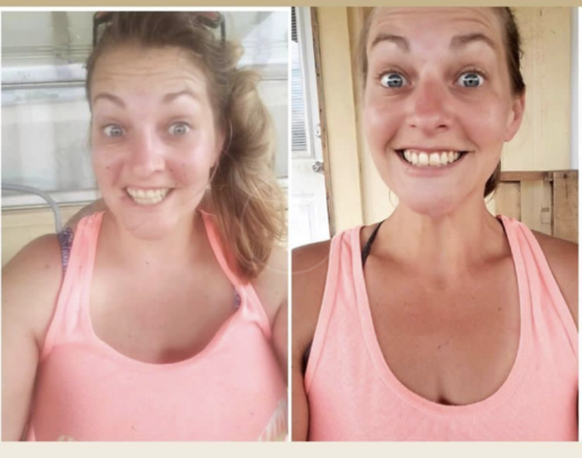 Connie's Before and After Photos